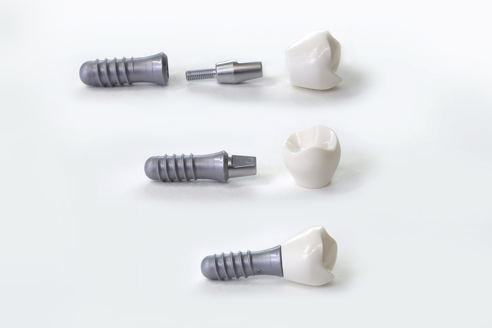 Kosten für Zahnimplantate