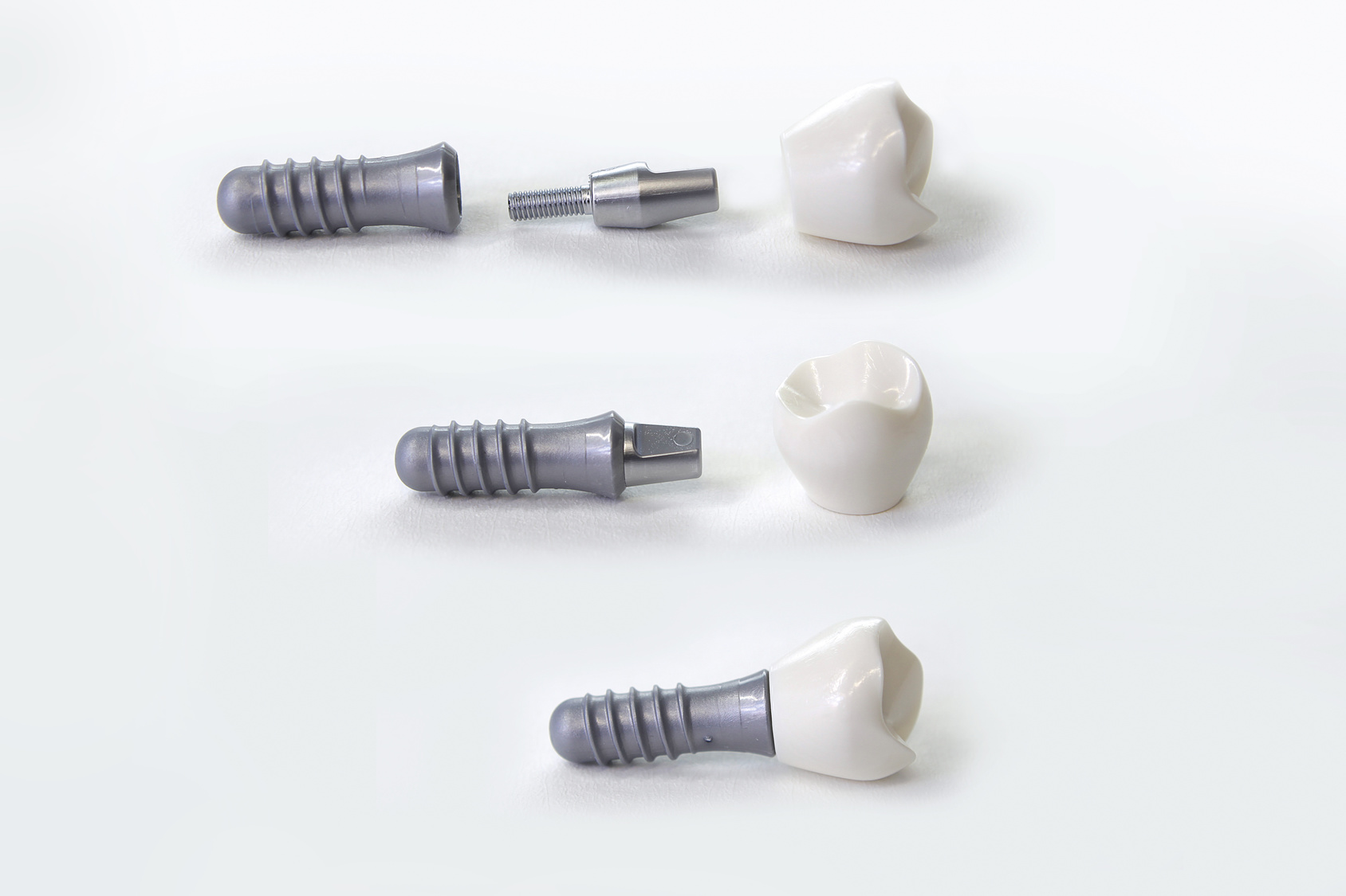 Hochwertiger Zahnersatz durch Implantate Kosten für Zahnimplantate